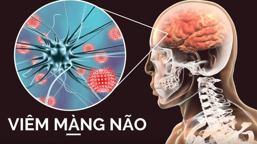 Viêm màng não vì nhiễm giun đũa từ chó, mèo